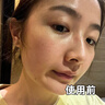Losoki瑞士進(jìn)口377面膜美白補(bǔ)水淡斑提亮膚色女男士抗皺緊致抗衰老熬夜 曬單實(shí)拍圖