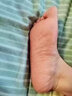 環(huán)吡酮胺乳膏治療真菌感染腳氣抗菌 角化型干裂腳氣藥腳干燥開(kāi)裂脫皮腳后跟干裂膏止癢脫皮爛腳丫真菌感染 3盒裝【脫皮開(kāi)裂增厚真菌感染】 曬單實(shí)拍圖