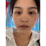迮川醫(yī)生眼霜淡化細(xì)紋提拉緊致黑眼圈重度去除祛男女士熬夜黑色素專用的藥 1盒裝 曬單實(shí)拍圖