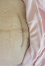 倍舒痕官方進(jìn)口Dermatix硅凝膠祛疤膏淡化增生瘢痕術(shù)后產(chǎn)外傷成人款7g 曬單實(shí)拍圖
