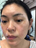 片仔癀美白淡斑套裝組合淡化黑色素去雀斑老年黃褐斑煙酰胺祛斑霜護膚品 美白祛斑4件套 水+凝露+精華+膏 曬單實(shí)拍圖
