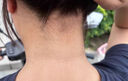 TVLV脖子黑色素去除黑棘皮癥治黑脖子病克星肘部腋下黑皮去黑專(zhuān)用膏藥 多維美白透亮嫩膚頸霜 曬單實(shí)拍圖