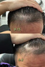labvinas碧力亞絲米諾地爾酊5%生發(fā)液非泡沫防脫生發(fā)西班牙進(jìn)口生發(fā)劑增發(fā)密發(fā)脂溢性脫發(fā) 曬單實(shí)拍圖