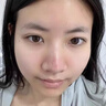 Redact澳洲抬頭紋川字紋貼去除神器額頭皺紋貼去除男女抗皺緊致衰老專(zhuān)用 曬單實(shí)拍圖