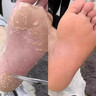 CNDK外用腳臭腳汽腳輕松噴霧劑足部腳癢水泡脫皮糜爛腳汗男女通用溫和 濃度999+【強效款嚴(yán)重腳氣】 曬單實拍圖