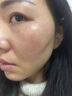 焦博士日本熊果苷乳膏煙酰胺凝膠377美白祛斑霜祛斑美白淡化黑色素面霜 曬單實拍圖