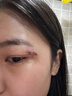 本田制藥祛疤痕修復(fù)凝膠醫(yī)院專用去疤痕藥膏硅酮疤痕凝膠修復(fù)除疤膏1盒 曬單實拍圖