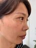 膚研祛斑霜祛斑黃褐斑雀斑曬斑男女士用的中藥老年斑專(zhuān)用特非藥一夜消 1盒【強效果最好的產(chǎn)品】 臉部手背祛斑專(zhuān)用霜去老人斑特效 曬單實(shí)拍圖