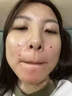 HEBST去痣點(diǎn)痣膏專(zhuān)用藥臉部不留疤祛痣膏點(diǎn)疣藥水正品無(wú)痛無(wú)痕 曬單實(shí)拍圖