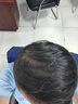 Tinstar云鬢生發(fā)膠囊密發(fā)科技內服固發(fā)護發(fā)防脫發(fā)修護靶向毛囊生物素養發(fā) 四瓶周期裝【中度發(fā)量失衡推薦/買(mǎi)3贈1】 曬單實(shí)拍圖