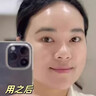 SKISGEM德國進(jìn)口面膜美白補(bǔ)水淡斑提亮膚色面膜改善暗沉男女生日禮物 曬單實拍圖