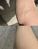 DRVIALY德國(guó)靜脈曲張專用貼膏可搭彈力襪醫(yī)用冷敷凝膠蚯蚓腿部麻木特姣藥 3盒【蚯蚓腿青筋凸起100%特效】 曬單實(shí)拍圖