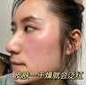 醫用冷敷貼面膜型械字號透明質(zhì)酸鈉修復貼敷料醫美術(shù)后消炎去紅美白補水曬后修復收縮毛孔祛痘控油淡化痘印 曬單實(shí)拍圖