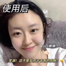 維特絲（vetes）去角質(zhì)面部啫喱控油保濕洗面奶男女士清潔毛孔黑頭閉口溫沒(méi)激素和 【6大專(zhuān)利】果酸去角質(zhì)啫喱200g 曬單實(shí)拍圖