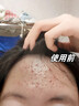 Losoki瑞士進(jìn)口氨基酸洗面奶祛痘深層清潔美白控油去黑頭收縮毛孔男女士 曬單實(shí)拍圖