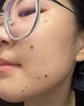 FLYMAN點痣膏水疤痕修復去痣點痣膏點疣水醫(yī)用專用(非藥)官方正品祛痣膏 套裝一:【點痣+修復】一盒 (100%發(fā)貨特效快)美容院專用不留疤不留坑 曬單實拍圖