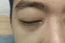 協(xié)和黑眼圈重度去除黑色素去黑眼圈男女士專用眼部黑色素沉淀眼康膏 單盒裝【黑眼圈眼袋患者專用】 祛黑眼圈淡化細紋提拉緊致眼袋貼 曬單實拍圖