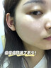 南京同仁堂祛痘膏去痘痘和痘印痘坑修復男女士改善粉刺閉口30g 曬單實(shí)拍圖