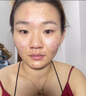 醫用冷敷貼面膜械字號醫美術(shù)后消炎美白補水曬后修復收縮毛孔祛痘淡化痘印生長(cháng)因子重組三型人源膠原蛋白敷料 曬單實(shí)拍圖