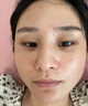 焦博士日本377祛斑霜美白淡化老年黃褐雀斑黑色素熊果苷乳膏去曬男女士 曬單實拍圖