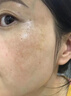 焦博士日本377祛斑霜美白淡化老年黃褐雀斑黑色素熊果苷乳膏去曬男女士 曬單實(shí)拍圖
