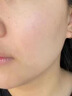 秋雅奈緒去除疣體藥膏疣清寧扁平疣絲狀瘊猴子專用脫落膏祛疣神器點(diǎn)痣藥水 祛疣液1盒【進(jìn)口祛疣刺猴疙瘩】 去除面部脖子上小肉粒尤皮贅醫(yī)用 曬單實(shí)拍圖