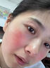 醫用冷敷貼面膜械字號醫美術(shù)后消炎美白補水曬后修復收縮毛孔祛痘淡化痘印生長(cháng)因子重組三型人源膠原蛋白敷料 曬單實(shí)拍圖