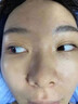 云南本草顆粒清肌膏 可搭正品眼周脂肪粒眼霜草本植物顆粒清肌精華液眼部脂肪粒油脂粒黑眼圈男女通用 兩支特惠裝+棉簽 曬單實拍圖