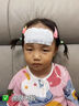 白云山醫用退熱貼5片裝兒童嬰幼兒專(zhuān)用感溫變色持久物理降溫退燒冰涼貼 曬單實(shí)拍圖