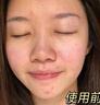 曼逖377氨基酸洗面奶500g男女士美白淡斑提亮膚色控油抗痘黑頭潔面乳 曬單實拍圖