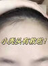 北京同仁堂生發(fā)洗發(fā)水胖東來防脫生發(fā)增發(fā)密發(fā)育發(fā)生姜去屑止癢控油激活毛囊 550mL 北京同仁堂洗發(fā)水-三瓶 曬單實拍圖