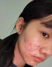 Newliann醫(yī)用械字號洗面奶狀潔面乳控油祛痘除螨蟲去黑頭男士女士修復屏障 曬單實拍圖