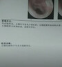 【日本品牌】耳膜穿孔修復專用滴耳液中耳炎耳道發(fā)炎流膿可搭藥BD 送棉簽【兩盒優(yōu)惠裝】第二盒半價 曬單實拍圖