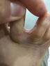 達(dá)克寧腳氣藥止癢脫皮爛腳丫真菌感染治腳氣皮膚用藥 非處方藥爛腳丫的特藥腳爛腳趾縫水泡癢硝酸咪康唑乳膏 2盒【硝酸咪康唑乳膏】癢的受不了 老是摳腳 達(dá)克寧腳氣藥止癢脫皮爛腳丫真菌感染治腳氣 曬單實(shí)拍圖