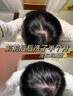 白云山二硫化硒洗發(fā)水380ml控油去屑持久蓬松止癢洗發(fā)膏露男女士金榜第1 曬單實拍圖