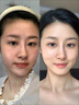 醫(yī)奧納HIME嘿米基因akg抗哀AKG男女款逆齡片最新版未來(lái)之星 [正品GeneAKG]醫(yī)奧納HIME嘿米基因男款 曬單實(shí)拍圖