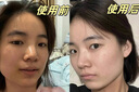 OHBT黃芪面膜10片抗皺緊致抗衰老補水熬夜美白淡斑女男士金榜第1名 曬單實拍圖