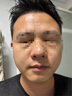 儒意（RUYI）紫蘇壬二酸清潔泥膜150g面膜深層去黑頭收縮毛孔祛痘金榜第1名 曬單實(shí)拍圖