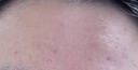 普門科技醫(yī)用大排燈美容儀紅藍(lán)黃光治療敏感肌痘痘痤瘡消炎鎮(zhèn)痛 光E【三光+12模式】 曬單實(shí)拍圖