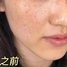 透真美白淡斑精華液 377抗皺緊致美白提亮 577祛斑緊致去黃vc精華 曬單實拍圖