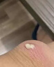 皮脂腺囊腫專用藥膏拔毒藥膏火癤子膿包疙瘩皮脂腺囊腫脂肪瘤專用特硬塊效藥皮膚用藥 非處方藥莫匹羅星軟膏 1盒【皮脂腺囊腫專用藥膏】早用早好 曬單實拍圖
