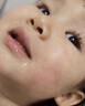 華美科醫(yī)用重組人體表皮生長因子點(diǎn)痣疤痕修復(fù)凝膠燙軟膏傷口愈合15g1支 曬單實(shí)拍圖