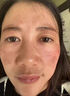 臉上黑色素沉淀去除臉部排毒排黑色素去黑斑點(diǎn)去黑色素臉部醫(yī)用皮膚色素暗沉痘印曬斑淡斑美白熊果苷軟膏 單盒裝【免費(fèi)試用】 曬單實(shí)拍圖