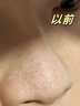 泊紫汀蘭（Pozitilan）洗面奶男士控油祛痘除螨蟲(chóng)去黑頭收縮毛孔亮白保濕氨基酸潔面乳 曬單實(shí)拍圖