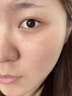 南京同仁堂祛痘膏去痘痘和痘印痘坑修復(fù)男女士改善粉刺閉口30g 曬單實(shí)拍圖