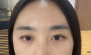歐誘眼袋霜去大眼袋嚴(yán)重中老年專用消除重度男女士眼袋祛去除神器貼膜 單盒裝：去眼袋最好的眼霜 曬單實(shí)拍圖