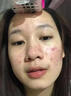 韓方五谷壬二酸祛痘藥膏去痘痘和淡化痘印精華液護膚品青春痘男女學(xué)生 曬單實拍圖