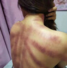 12D精雕儀器身體塑形美容院58D體雕儀三通大師經(jīng)絡(luò )疏通養生按摩儀 12D超級精雕儀【雙腹包+32杯】 曬單實(shí)拍圖