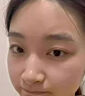 dyey點(diǎn)痣膏無(wú)痕去痣黑痣瘊子點(diǎn)痣液扁平尤絲狀尤尖尤肉刺肉兒童可用 曬單實(shí)拍圖