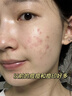 BEAUTY NOTES亞馬遜進(jìn)口白泥清潔面膜果酸去黑頭粉刺痘印收縮毛孔涂抹式140g 曬單實(shí)拍圖